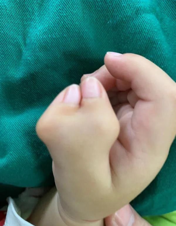 六指|宝宝刚出生长“六指”，婆婆一句话，妈妈懵了