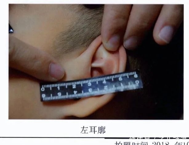  孩子|天津金色摇篮幼儿园针扎虐童案审判：5名幼师均获刑