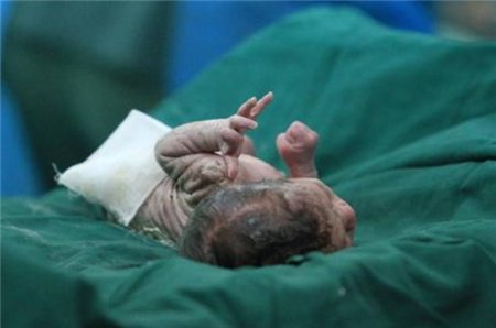  检查|秘鲁5岁女童肚大如鼓，竟生下男婴？背后实情令人惊诧