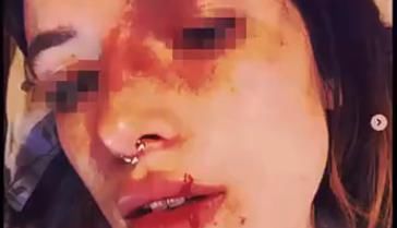  杨某|突发！南宁一公交车撞上护栏，多人受伤！| 一起来关注