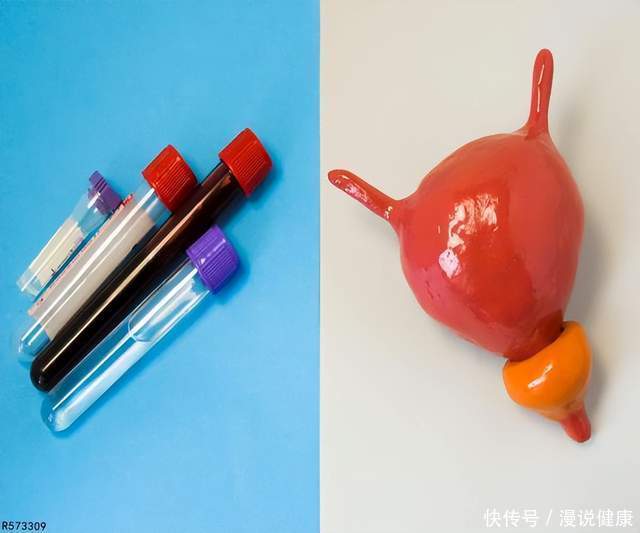 抽血哪个指标可以看出癌(体内有癌，抽血便知？血常规这3种指标，还真能查出“蛛丝马迹”)