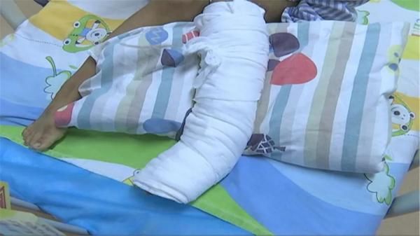  医院|惊！毒蛇溜进家，咬伤6岁孩子！这份自救常识能救命！