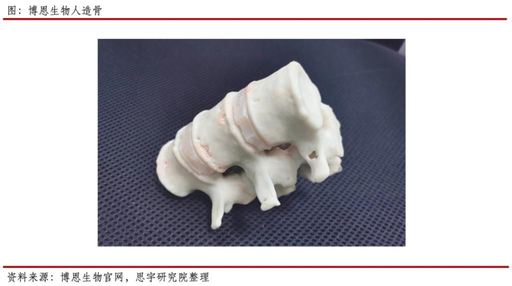 骨会|行业｜需要骨修复的患者越来越多，人工骨会是他们的救星吗？