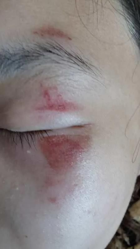  主人|保定一女孩在公园被大狗追逐摔伤，狗主人未道歉便离去