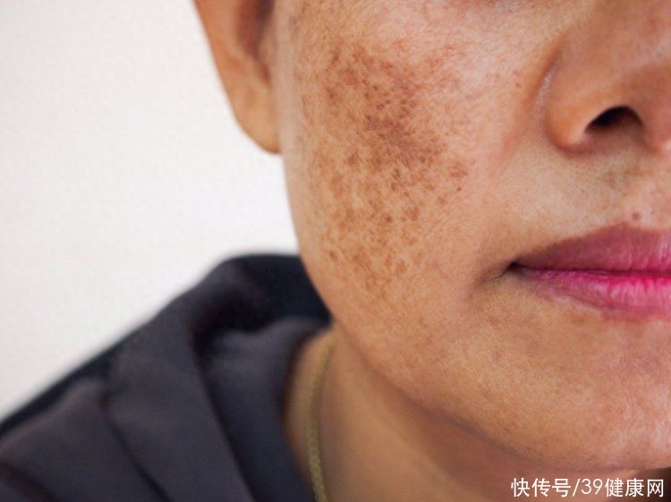 服用维生素E有什么好处和坏处(经常吃维生素E，有啥好处？提醒：服用维E要谨慎，3类人不建议吃)