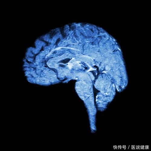 高血压叶酸和孕妇叶酸一样吗(高血压患者吃叶酸可预防脑血管堵塞，但叶酸过量问题也需注意)