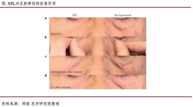  狂人|乘风破浪的科学狂人和他们的人造皮肤