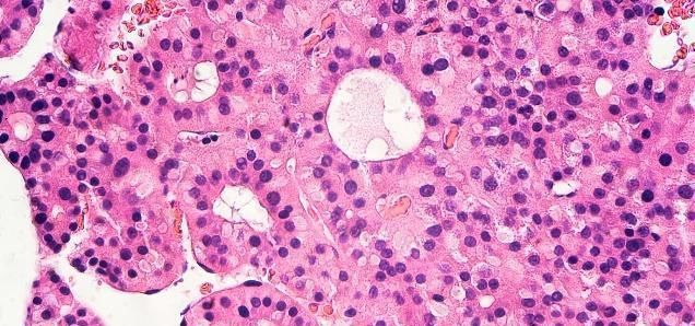  营养成分|每天晨起一碗“鸡蛋茶”，坚持一段时间会怎样？或许会有3个疗效