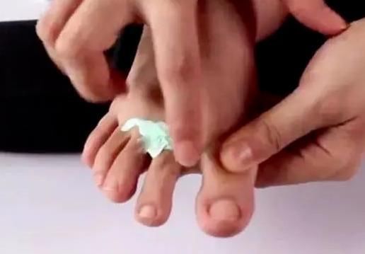  感谢|把牙膏挤一点抹在脚趾上，看完你会感谢我的，不知道的人太多了