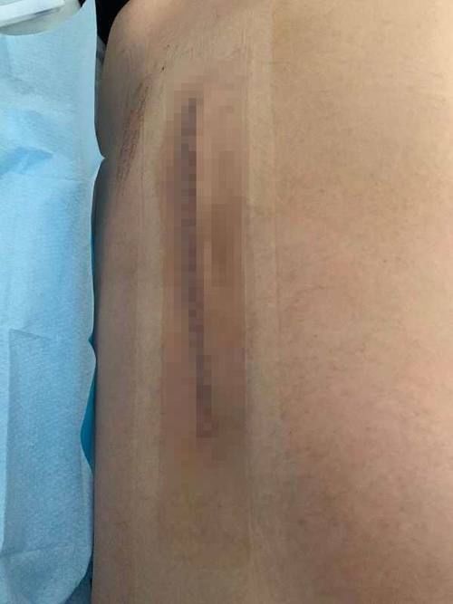 悬崖|3岁儿子景区小便,母亲被推下20米悬崖,索赔150万?警方回应!