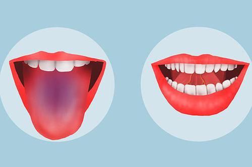  生病|舌头是身体晴雨表，哪些变化，说明你可能生病了？自测一下