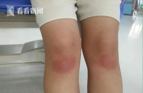  溺水|＂让我来＂女童溺水 她跪地施救10分钟＂抢＂回一命