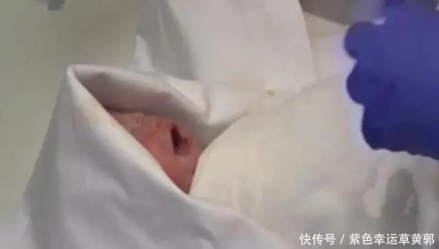 诞下|脑死亡117天后，27岁孕妇诞下女婴，家属同意关掉呼吸机