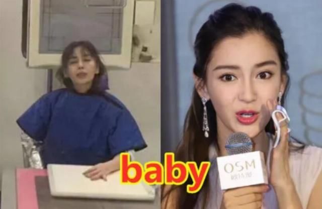  手指|明星录综艺时意外，张艺兴晕倒，baby手指骨折，她被搭档误伤！