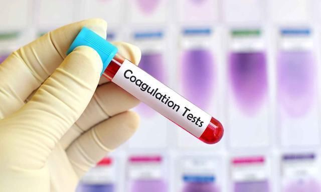  盯上|我这么瘦，怎么也被高血脂“盯上”了？医生：二者并无必然联系