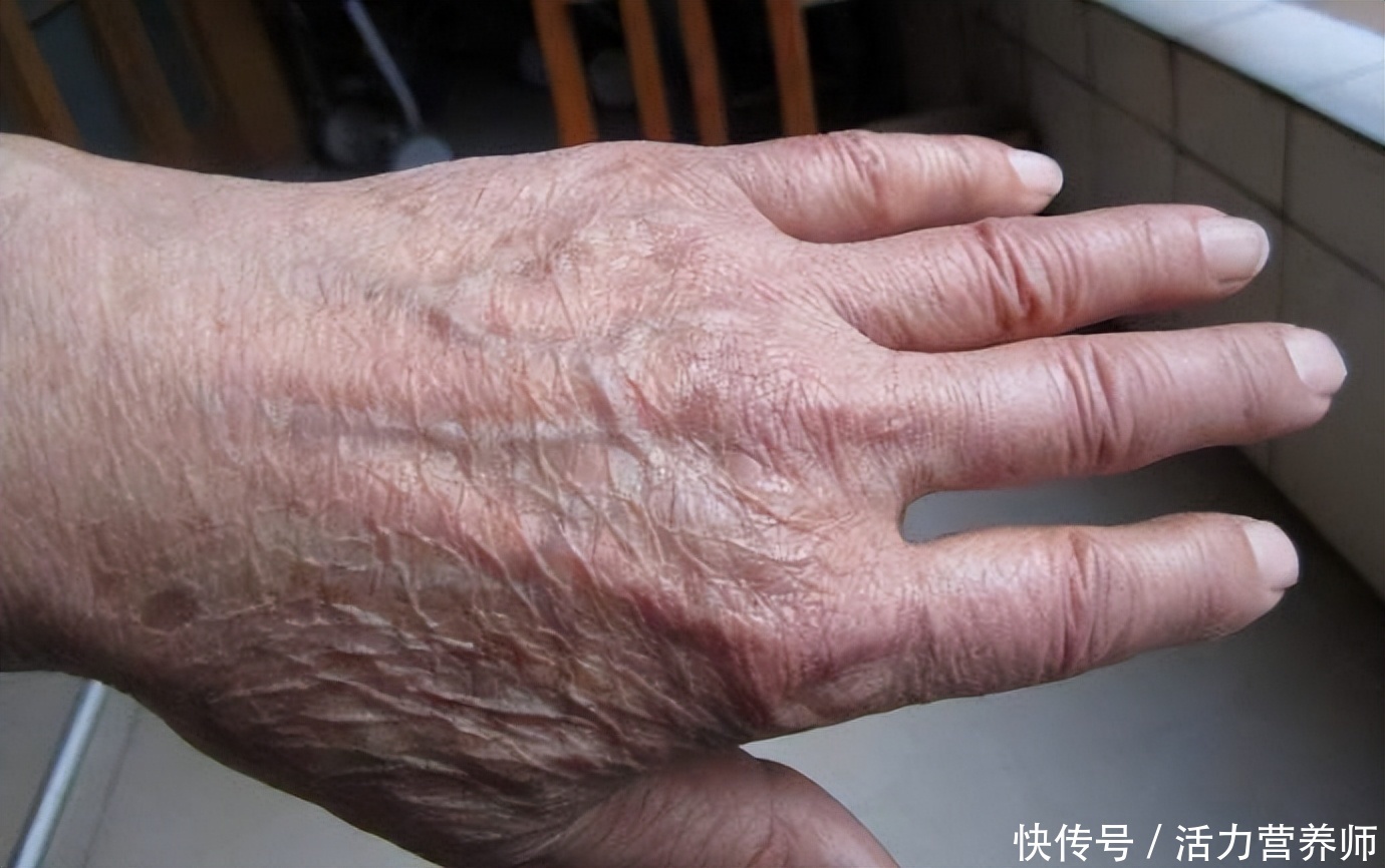 提醒父母以下5类病可能是老年病(作为儿女要提醒爸妈：这几种病是“老年病”，过度担心反伤身)