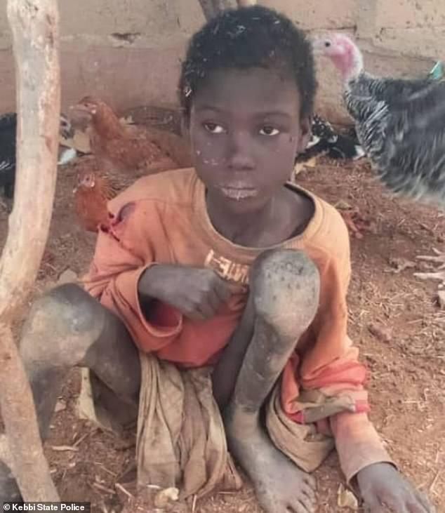  布林|这还是父母？非洲男孩被亲爹和后妈锁鸡棚两年，靠吃自己的粪便为生