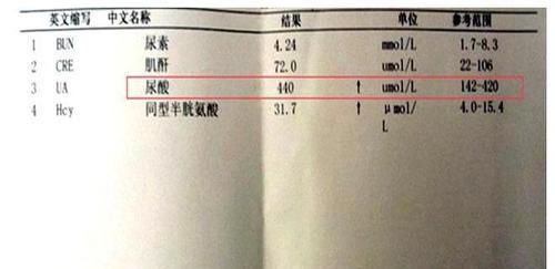  做好|尿酸超标的人，牢记少吃3菜，做好2事，尿酸易降到300以内