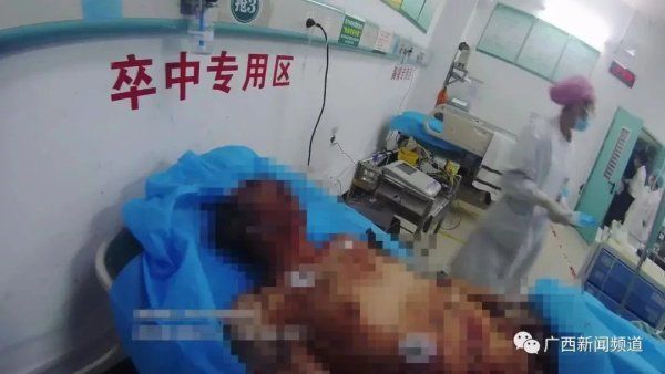  男子|血腥慎点！男子酒后在卫生间内跌了一跤，失去全身约三分之一血液