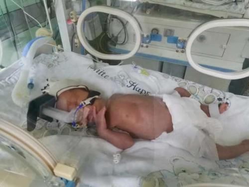 宝妈|97年宝妈成功生下3胞胎，却终日以泪洗面，原因是担心名字用不上