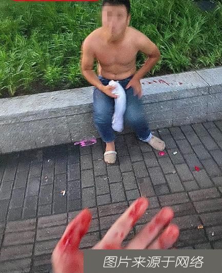 耳朵|男子见义勇为阻止性侵被咬掉半只耳，需做开颅手术，事后坚称“不后悔！”