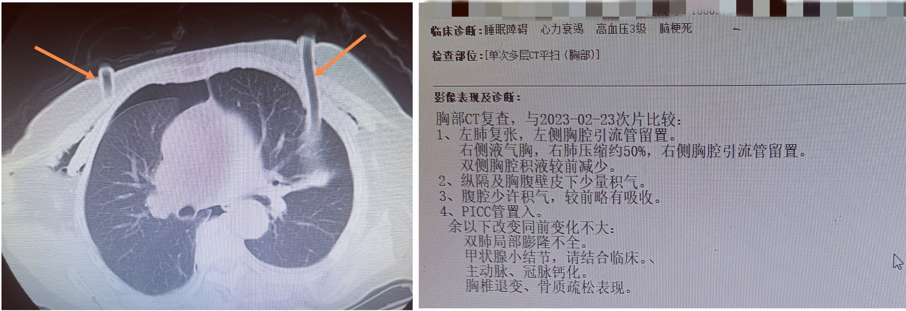 想说爱你不容易(麻醉，想说爱你不容易)