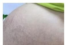  家人|双胞胎之后五胞胎，医院出动20名人员，得知性别亲戚都笑了