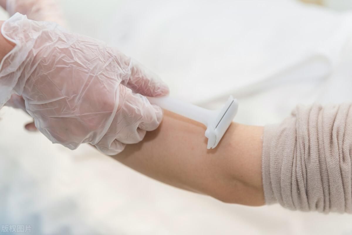 女生腋下毛发旺盛是什么原因(为什么有的女生毛发旺盛，有的却很干净？原因是什么？)