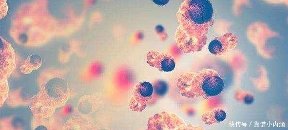 癌细胞|人体发烧到多少度,能彻底杀死癌细胞?这个数字让人不敢想象