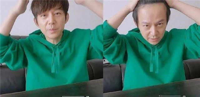  何炅太|当男明星发际线后移，何炅太喜感，胡歌简直没眼看