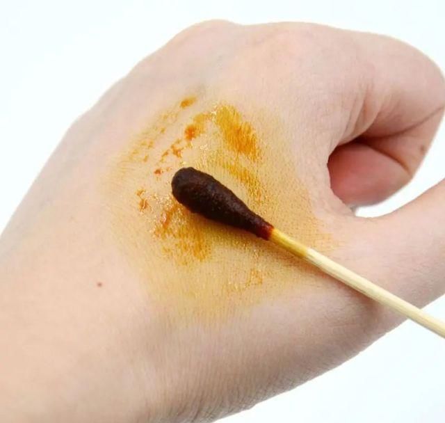  狂犬|狗子“拆家”还“拆我”？被宠物抓咬一定要打狂犬疫苗吗？