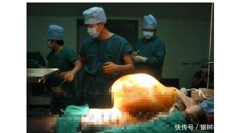 94岁老太肚子巨胀,医生开刀看清后,吓得医生发呆了整整9秒钟-第2张图片-大千世界 94岁老太肚子巨胀,医生开刀看清后,吓得医生发呆了整整9秒钟-第2张图片-大千世界