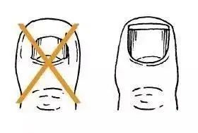  截肢|男子险被截肢，凶手竟是一条鱼！只因忽视了…