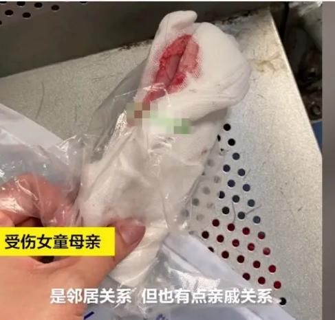  女童|6岁女童被远方亲戚用锄头猛击致重伤，凶手有精神病史