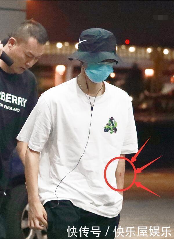 衣服|王一博818晚会后又录《街舞》,衣服皱伤口仍明显,助理打伞妖娆