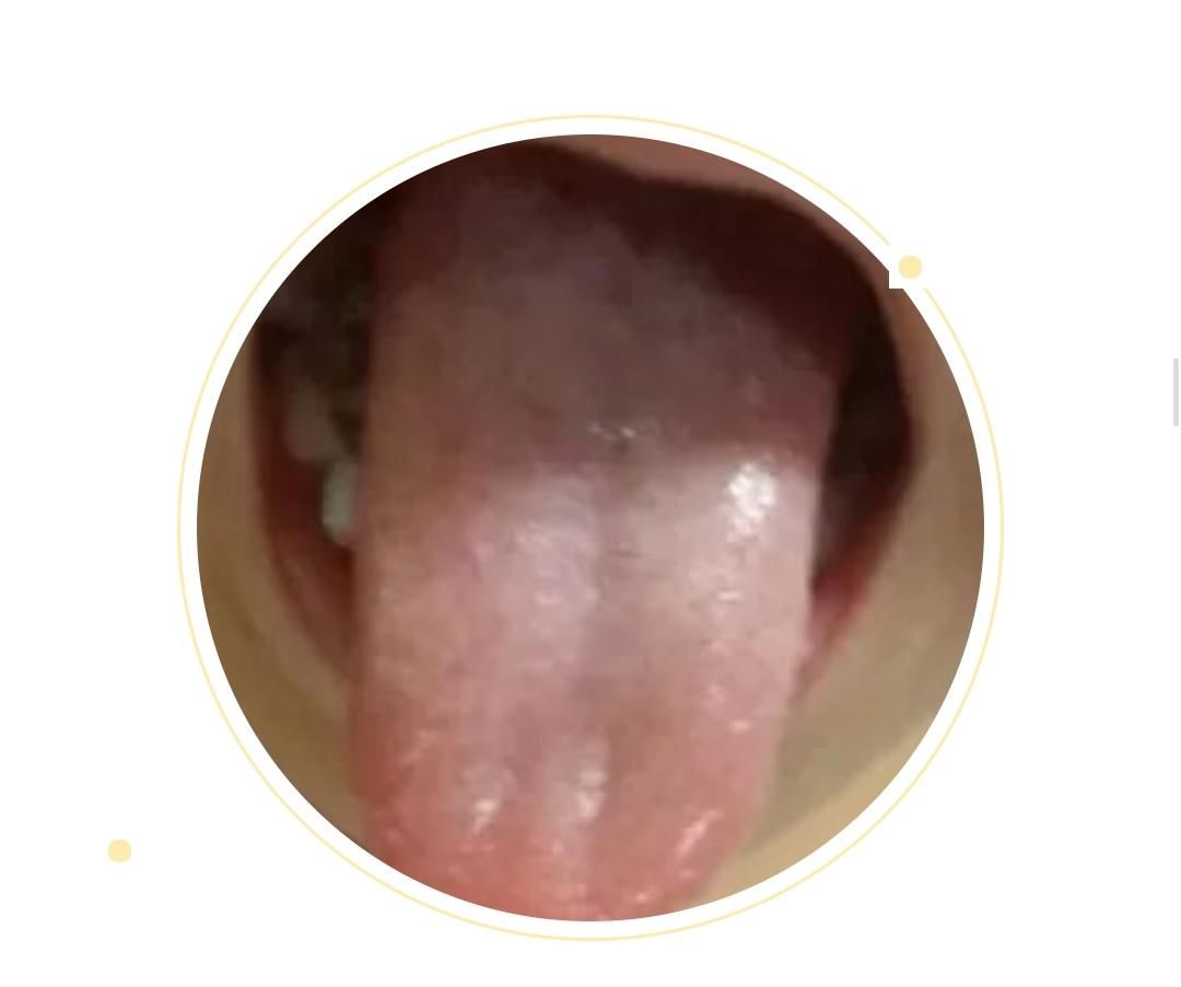  变化|身体健康情况怎么样？可以从舌头进行窥探