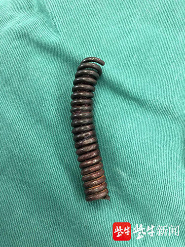  擅自|螺旋型钢管插入手臂， 25岁小伙没有擅自拔管“非常正确”