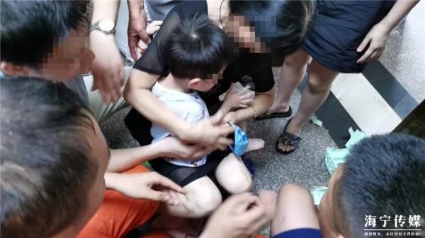  家中|浙江一幼儿手指被“吃”！这种东西家中常见，严重可截肢！