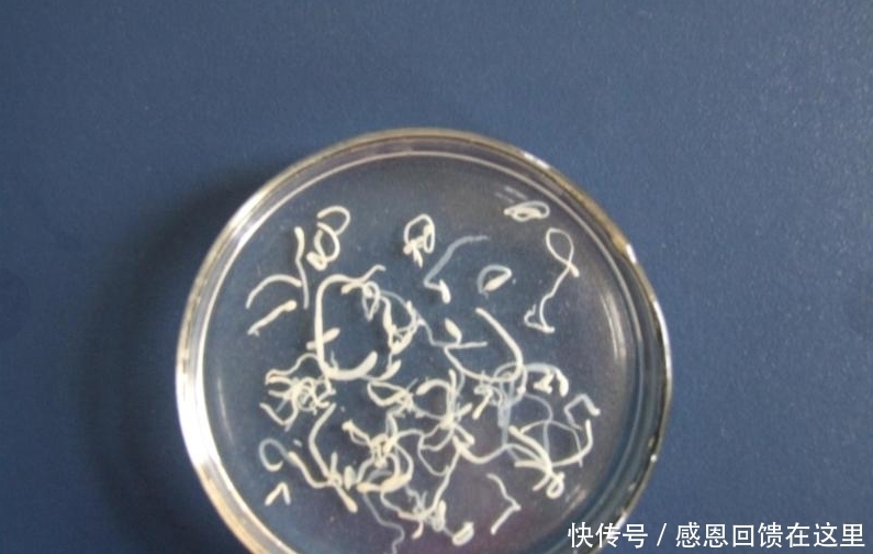  虫子|男子被吃脑虫入侵20天后病逝, 提醒: 这几种常见寄生虫得小心