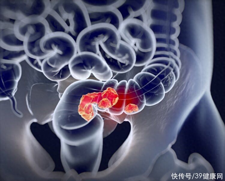 常揉腹部的六大好处(揉揉肚子能治百病？每天坚持揉一揉腹部，身体或能收获3个好处)