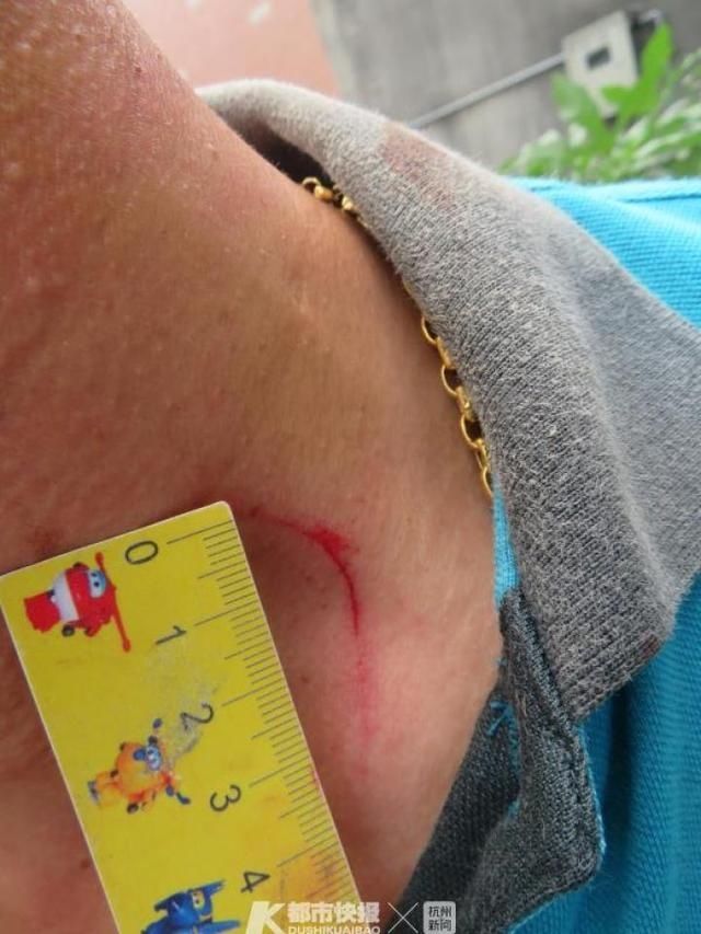 原因|关系乱!杭州两对夫妻打架,原因让人毁三观