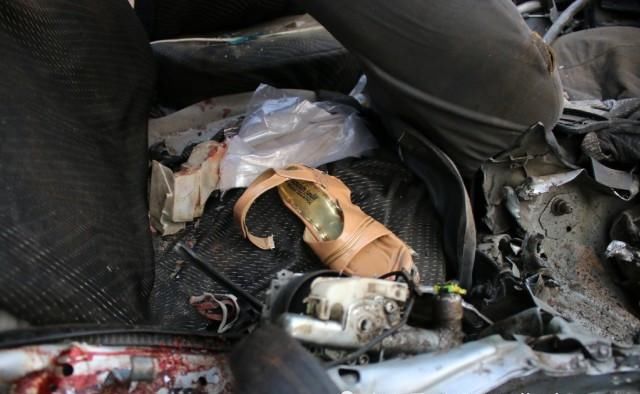  喝水|抢救室内，伤者口渴想喝水，医生一下把水打翻在地