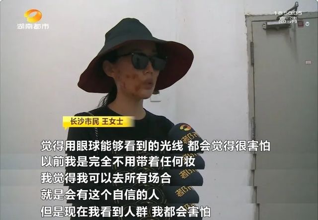  皮肤科连锁|美容变毁容，长沙一女子做超声刀致三度烧伤，出门全靠黑布遮挡