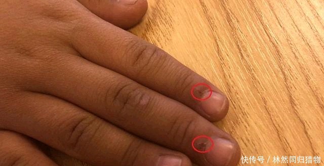  特征|孩子出现这两个特征，说明已经营养不良，妈妈多留意