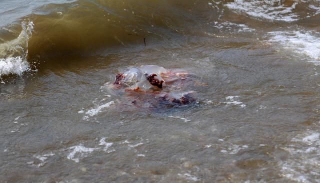  小男孩|?“妈妈，海里有东西扎人！”夏家河子浴场十多人受伤