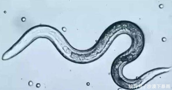  家里|女孩眼睛歪斜严重，竟和家里宠物有关，养宠物一定要注意这件事