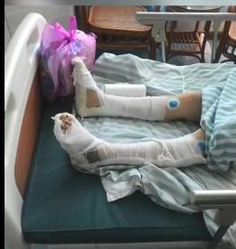 丈夫|女子跳楼造成双下肢瘫痪:我不是自杀,我是逃生!