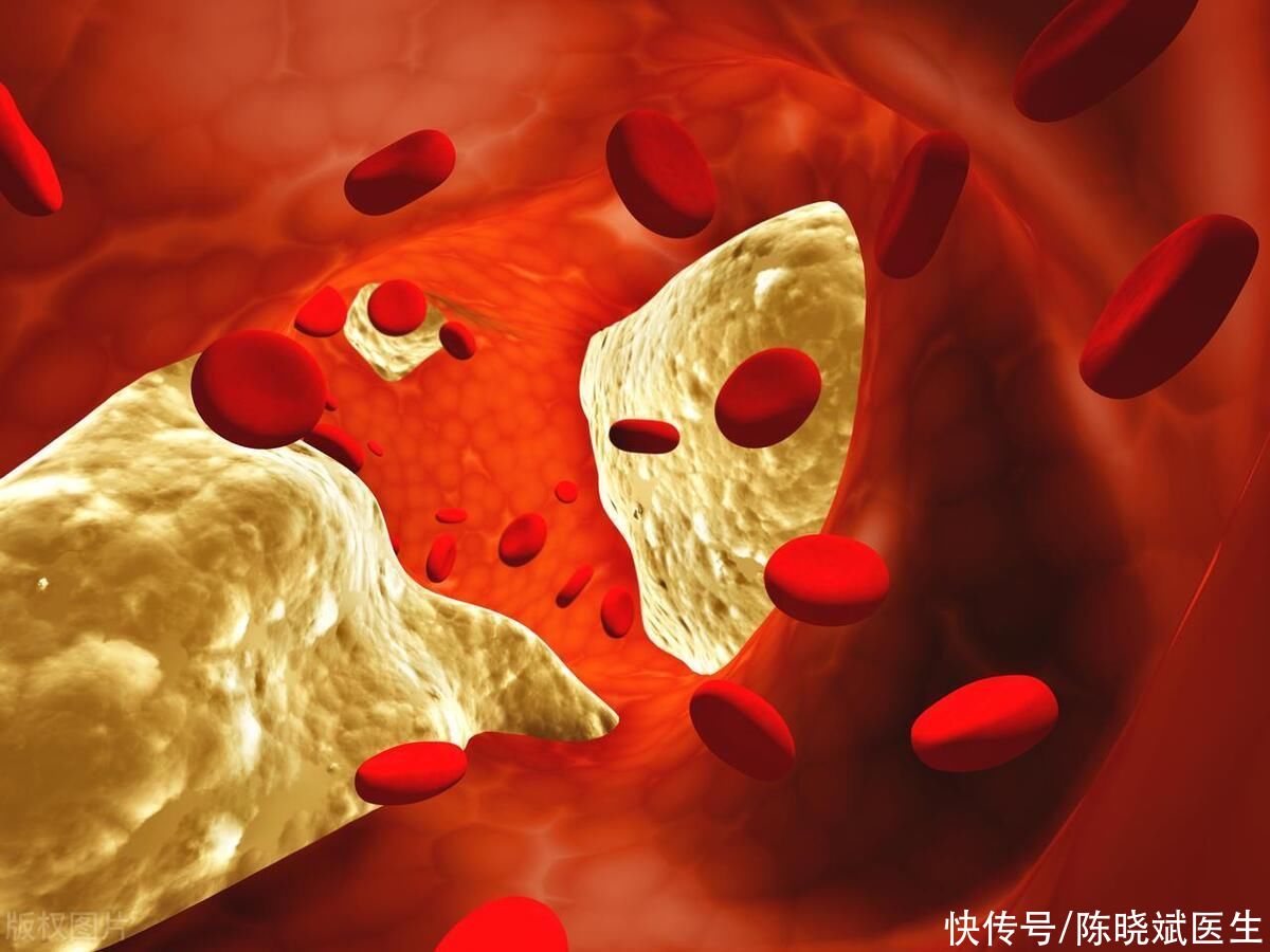 血管开始变硬会露出这4个马脚(血管开始变硬，身体会露出这4个“马脚”，建议你自查看看)