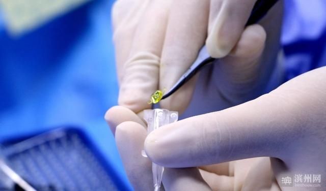  PanOptix|鲁北地区首例PanOptix新一代三焦点人工晶体植入术在滨州成功实施