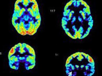  上热|又一起恶性犯罪案件上热搜，真的有「天生的坏人」吗？